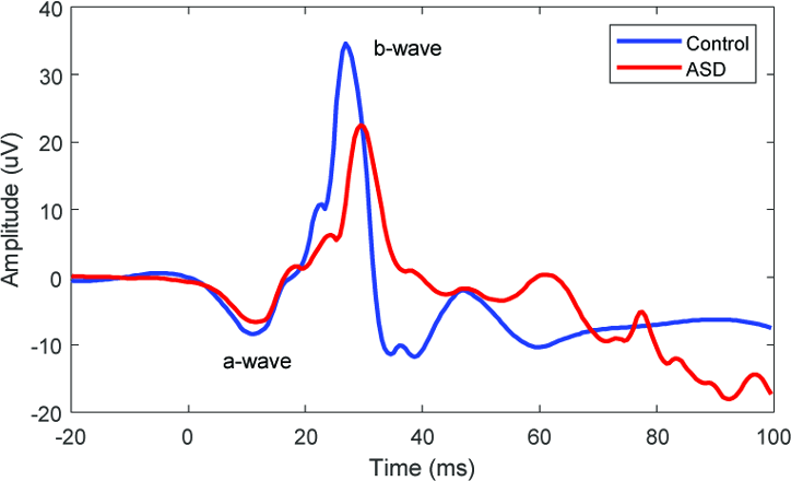 Example ERG plots