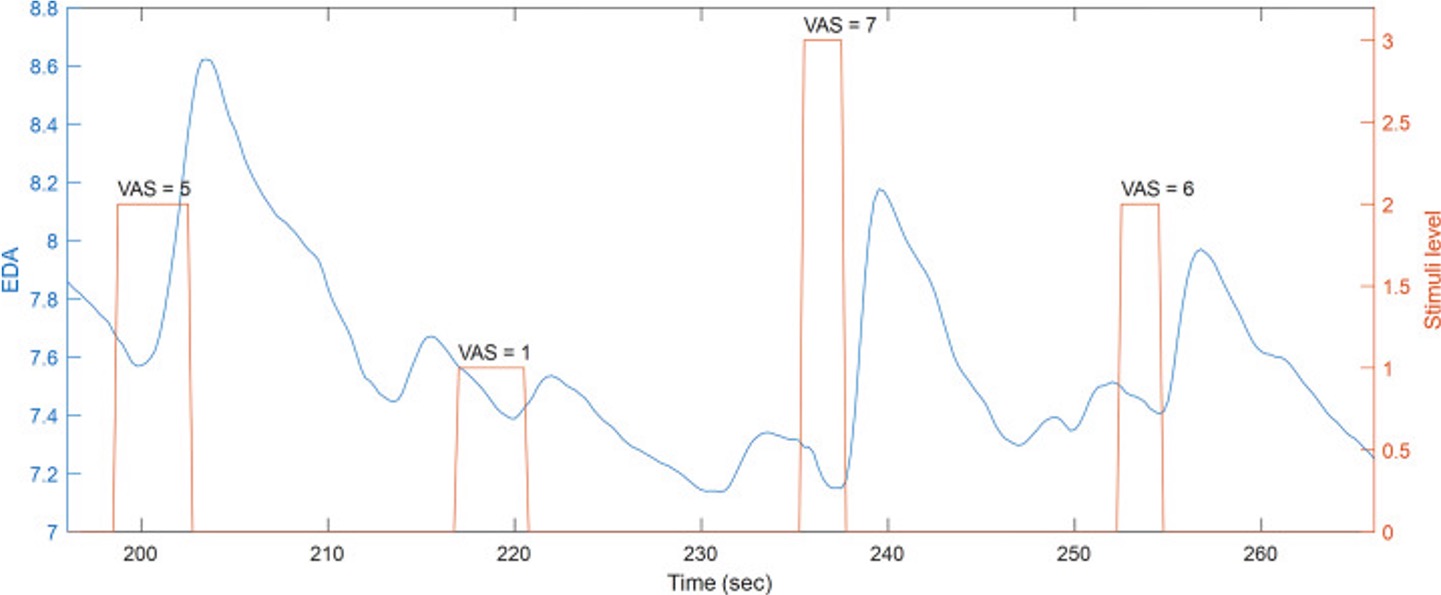 Labeled EDA graph